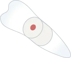 斜めからの図
