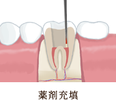 切開