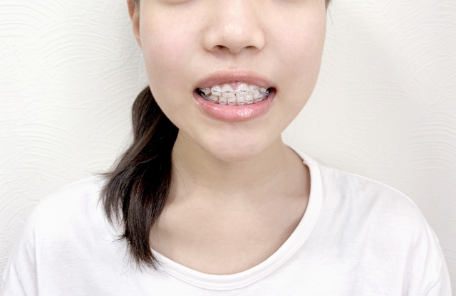 歯列矯正中の歯